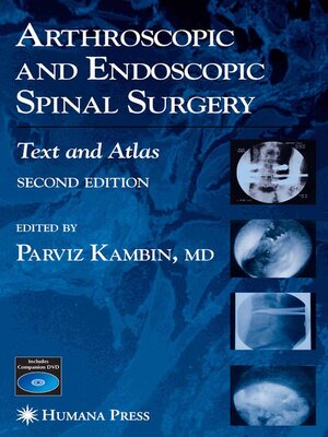 cover image of Arthroscopic and Endoscopic Spinal Surgery